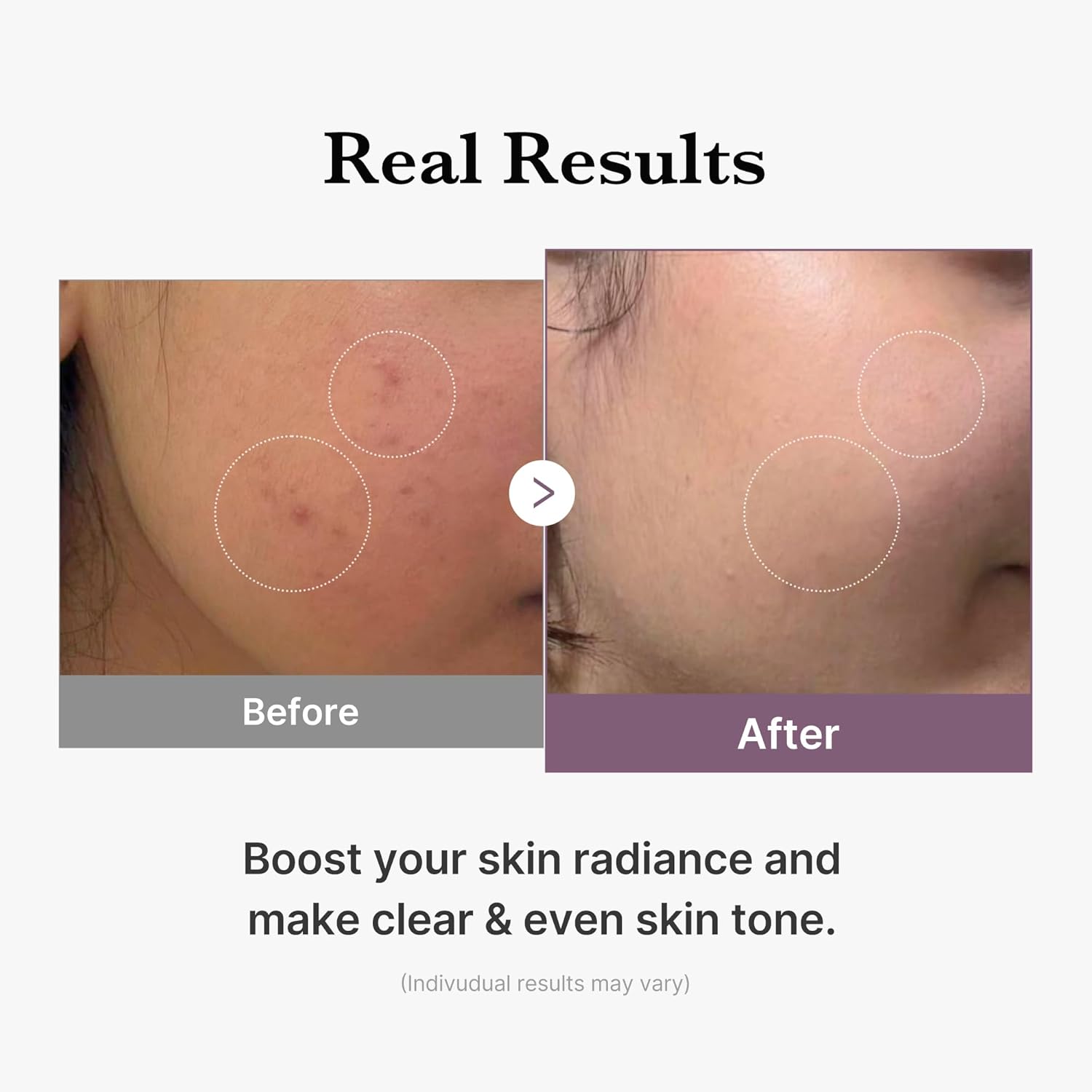 MEDICUBE Age-R Glutathione Glow Toner 140mL – KBeauty_B2B